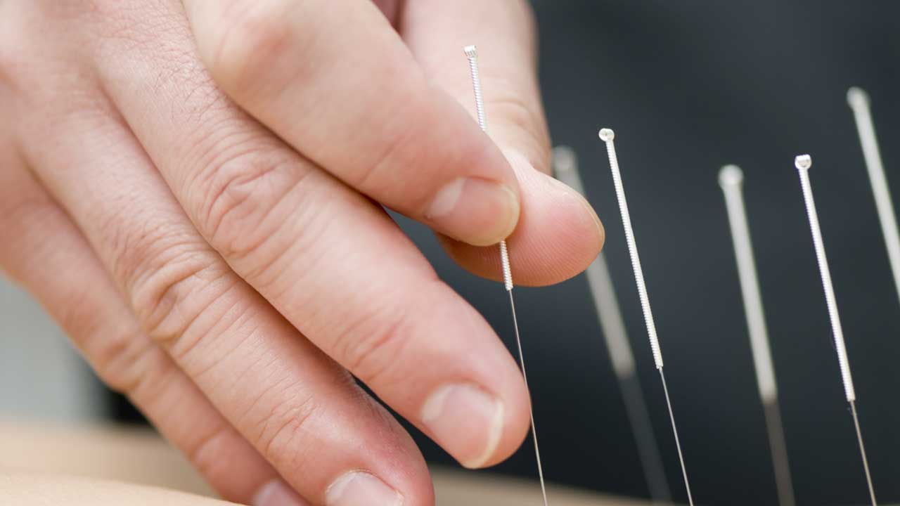 TRADITIONAL ACUPUNCTURE THERAPIES